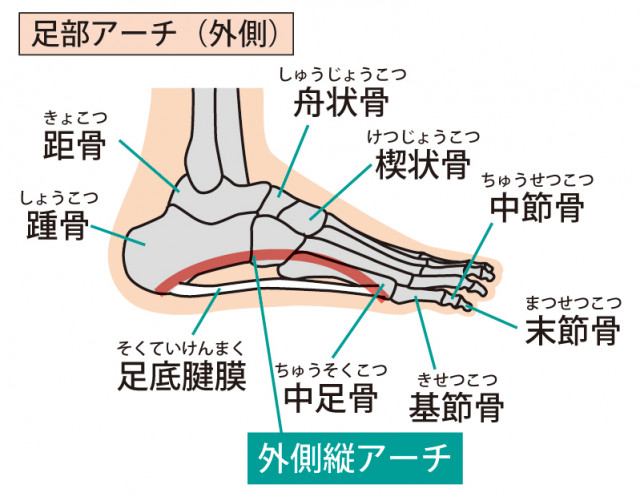 足底筋膜炎とは?