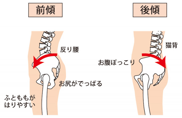 変形性股関節症への対処法は?