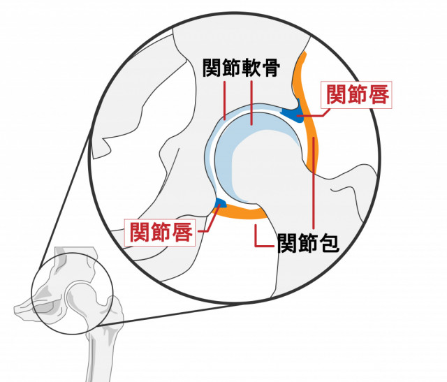 股関節の痛み改善にさいし、大切にしていること